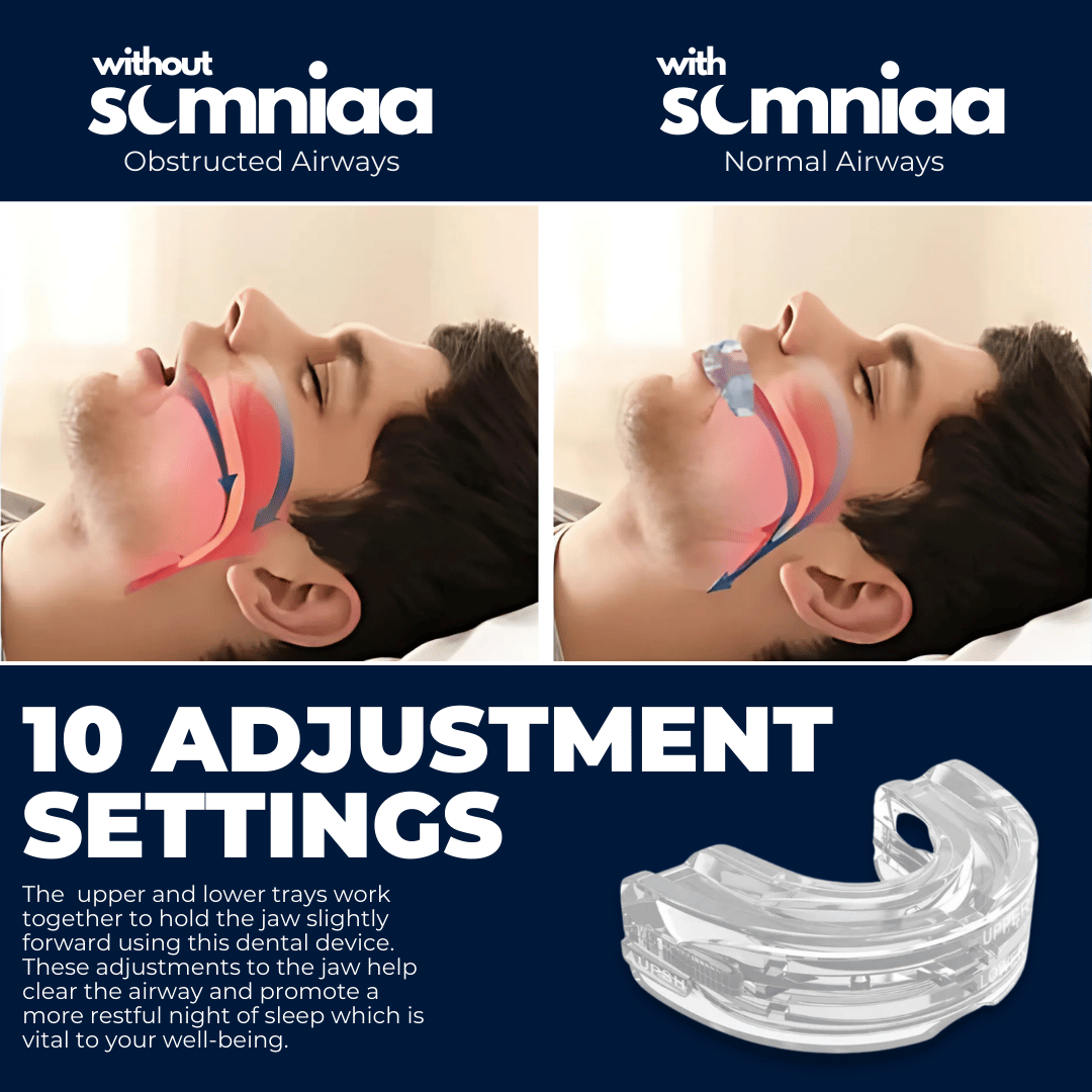 Somniaa 2.0 - Anti Snoring Mouthpiece(3 pieces), BPA Free